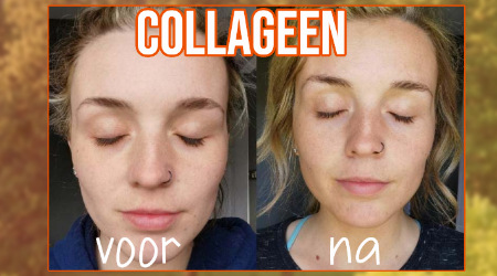 Een voor en na foto tonen het effect van collageen op de huid aan