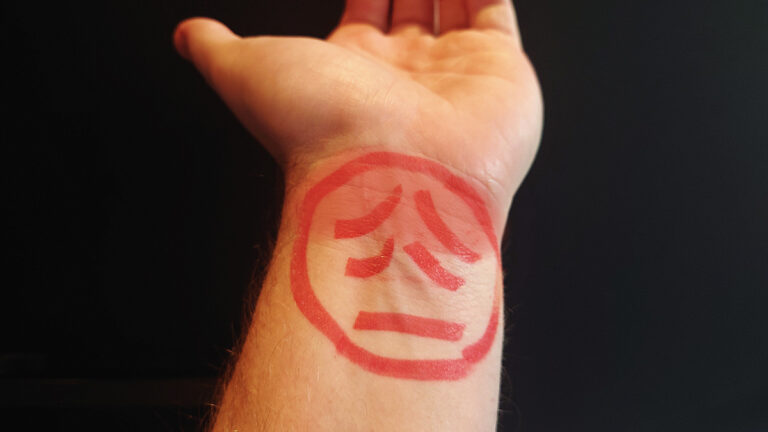 Je pols doet ineens pijn? Oorzaken & Oplossingen | MuscleMeister