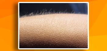 Huid met kippenvel en tintelingen